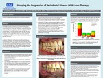 Stopping The Progression Of Periodontal Disease With Laser Therapy by Sarah Almukhtar, Autumn Baker, and Joann Moulton