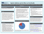 Opioid Addiction And Its Effect On Oral Health by Nicholas Chamberlain-Nunes, Andalena Chancio, and Annika Thomas