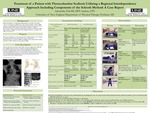 Treatment Of A Patient With Thoracolumbar Scoliosis Utilizing A Regional Interdependence Approach Including Components Of The Schroth Method: A Case Report by Samantha Fisk
