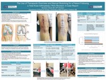 The Use Of Therapeutic Exercises And Manual Stretching For A Patient Following A Total Knee Arthroplasty (TKA) Revision: A Case Report by Nicholas Cebula